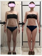 アバティック(ABatick)/身体引き締め集中コース