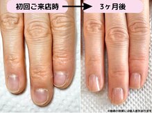 カピリナ(Ka Pilina)/最強のネイルケア