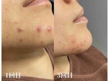 オアシス 岡崎(Oasis)/フェイシャルサロンOasis岡崎