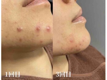 オアシス 岡崎(Oasis)/フェイシャルサロンOasis岡崎