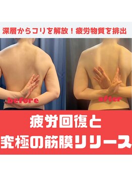 月香館/筋膜リリースで翼を生やす！