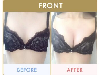 シャイニー(SHINY)/バストケア