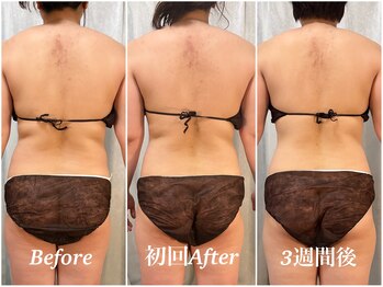 ヨサパーク ルルア(YOSA PARK Lulua)の写真/ゆったり落ち着いたサロンでリラックスしながら温活痩身♪【吉野町/横浜】