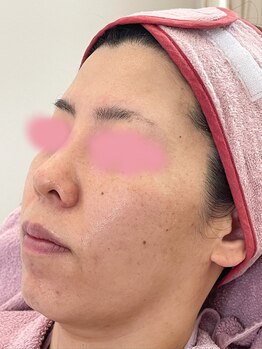 リフティングラボ(LIFTING LAB)/バイオセルショット65