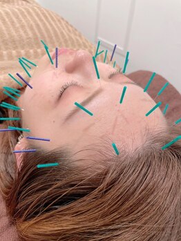 トゥービー(TWO-B)/むくみ、リフトアップ効果に♪