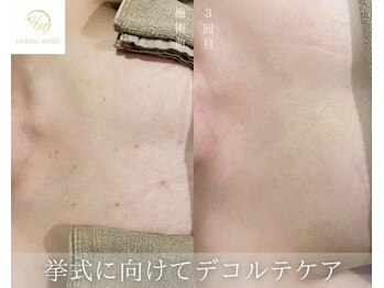 シュシュエステプリューム(Chou Chou Esthe PLUME)/