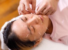 玉木鍼灸整骨院/美容鍼（電気美容鍼も可）