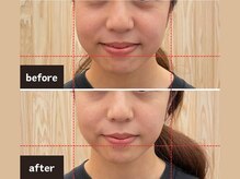 ととのえ処 良久庵/美容鍼