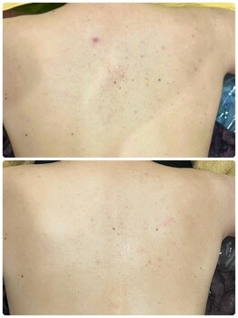 サンク アール(CinQ-R. 美九)/ブライダル