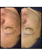 トータルビューティー ソラン(Soran)/韓国最新美容【CURAIM】肌管理