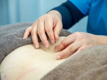 かがやき鍼灸整骨院/