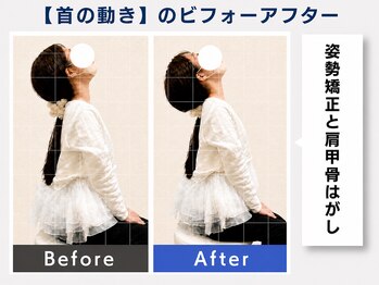 大阪心斎橋整体院/整体で首の痛み改善♪