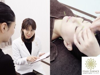ハリエッセンス(HARI ESSENCE)の写真/たるみや左右差をケアし小顔へ！美容鍼専門鍼灸院で若い顔の印象を目指す♪