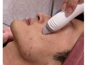 ラピス ラズリー(Lapis Lazuly)/ハイドラフェイシャル