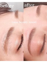 ラナビューティリゾート(Lana Beauty resort)/ハリウッドブロウリフト