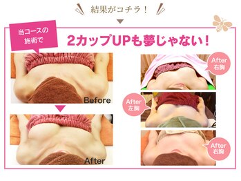 ファニービー 茨木本店/Before→After