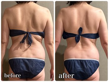 メロウ(me: llow)/痩身エステ/恵比寿