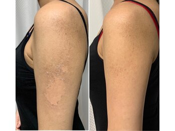 リベル 名古屋(Lebelle:)/ハーブピーリング専門名古屋