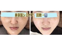 アルページュ(Arpege)/シミケア＆水滴管理トリプルLDM