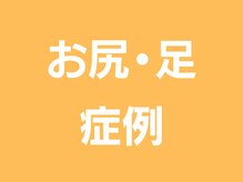 ミモザ鍼サロン(mimoza鍼サロン)/お尻・足のビフォーアフター