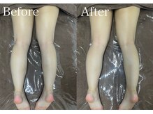 ブレスト サロン 奈良店(Bryst Salon)/痩身施術