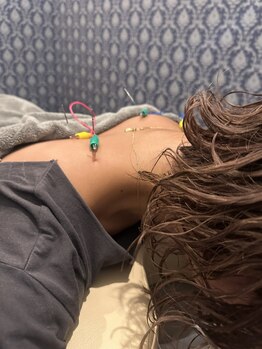 アロエ鍼灸整体院の写真/鍼灸×整体で深いお悩みを根本改善!鍼灸で体の緊張を緩め整いやすく◎肩こり/腰痛の痛み解消!