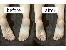 骨盤のゆがみが揃う！確かな技術をお届けします