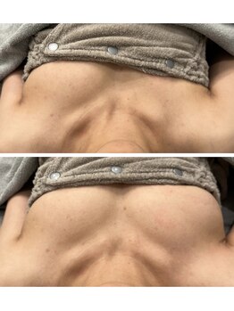 ソラ(sora)の写真/【美人バスト】諦めるにはまだ早い！お悩みに合わせて憧れのマシュマロバストに満足する事間違いなし◎