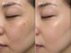 エクロール(E'clore)の写真/シミ/シワ/たるみなど年齢肌悩みの方にエイジングケア！小じわをふっくらし若々しい印象のお肌へ♪
