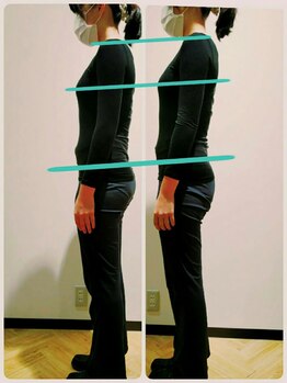 アニュームーン セルバ甲南山手店(a new moon)/施術後、身体の軽さを実感！