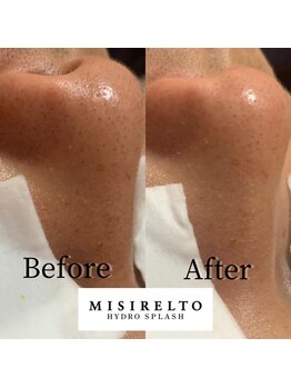 フェイシャルサロン アリイ(ALII)/優しく汚れを吸い取る毛穴洗浄