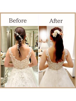 サロンルーチェ(Salon Luce)/ブライダル整体/施術回数6回