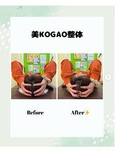 西明石わだち整骨院/美小顔矯正ビフォーアフター