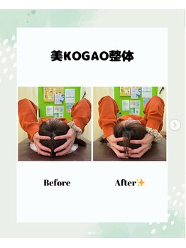 西明石わだち整骨院/美小顔矯正ビフォーアフター