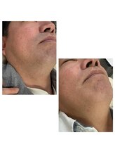 ミセレルオカザキ(MISEREL OKAZAKI)/