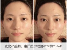 ミピマムの雰囲気（伝統的な東洋医学に基づいた本物のコルギ/やみつきになるコルギ）