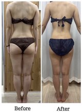 クリアプラス 小禄店(Clear+)/エルフィーノ50分