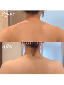 ルノン(Lunon)/【巻き肩/肩こり】肩甲骨はがし