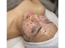 プロヴィオ(PROVIO)の雰囲気（毛穴にお悩みの方、水光肌になりたい方はお任せください！）