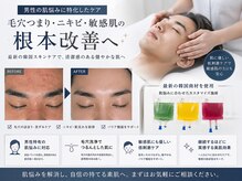 リベレ(Libelle)の雰囲気（男性の肌悩みにも対応★気軽にご相談下さい♪）