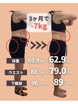 六甲もり鍼灸整体院/ダイエット 3ヵ月コース