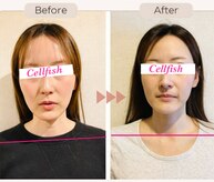 セルフィッシュ(Cellfish)
