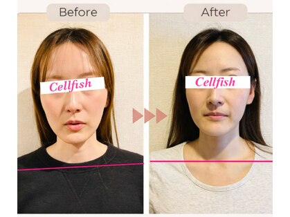 セルフィッシュ(Cellfish)の写真