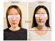 セルフィッシュ(Cellfish)の写真