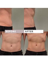 あおい鳥/中野初上陸◎痩身機器効果抜群