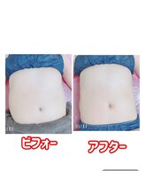 ルクール(Le Couer)/４０代痩身１回の効果