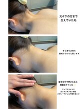 カーロ(CARO)/うなじ脱毛