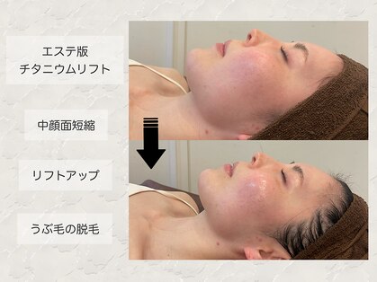 クレスト(CLEST.)の写真