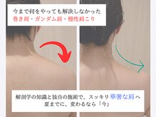 カド 白金台(Kado)/高評価◆インディバ整体