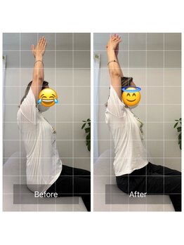 ナオル整体 恵比寿院(NAORU整体)/恵比寿/整体事例